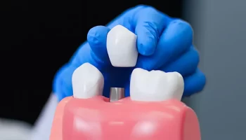 Do You Know Dental Implants can Enhance Your Oral Appearance?